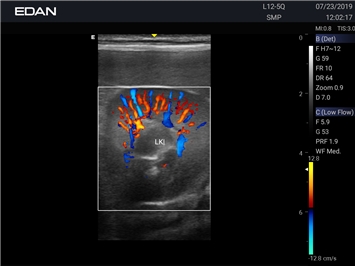 EDAN Acclarix AX8 VET