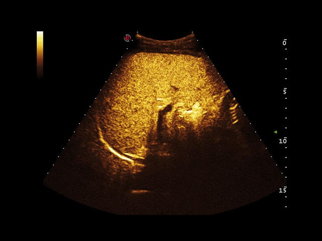 Esaote MyLab Class C