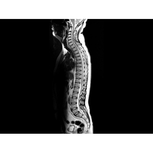 МРТ аппарат GE Optima MR450w 1.5T